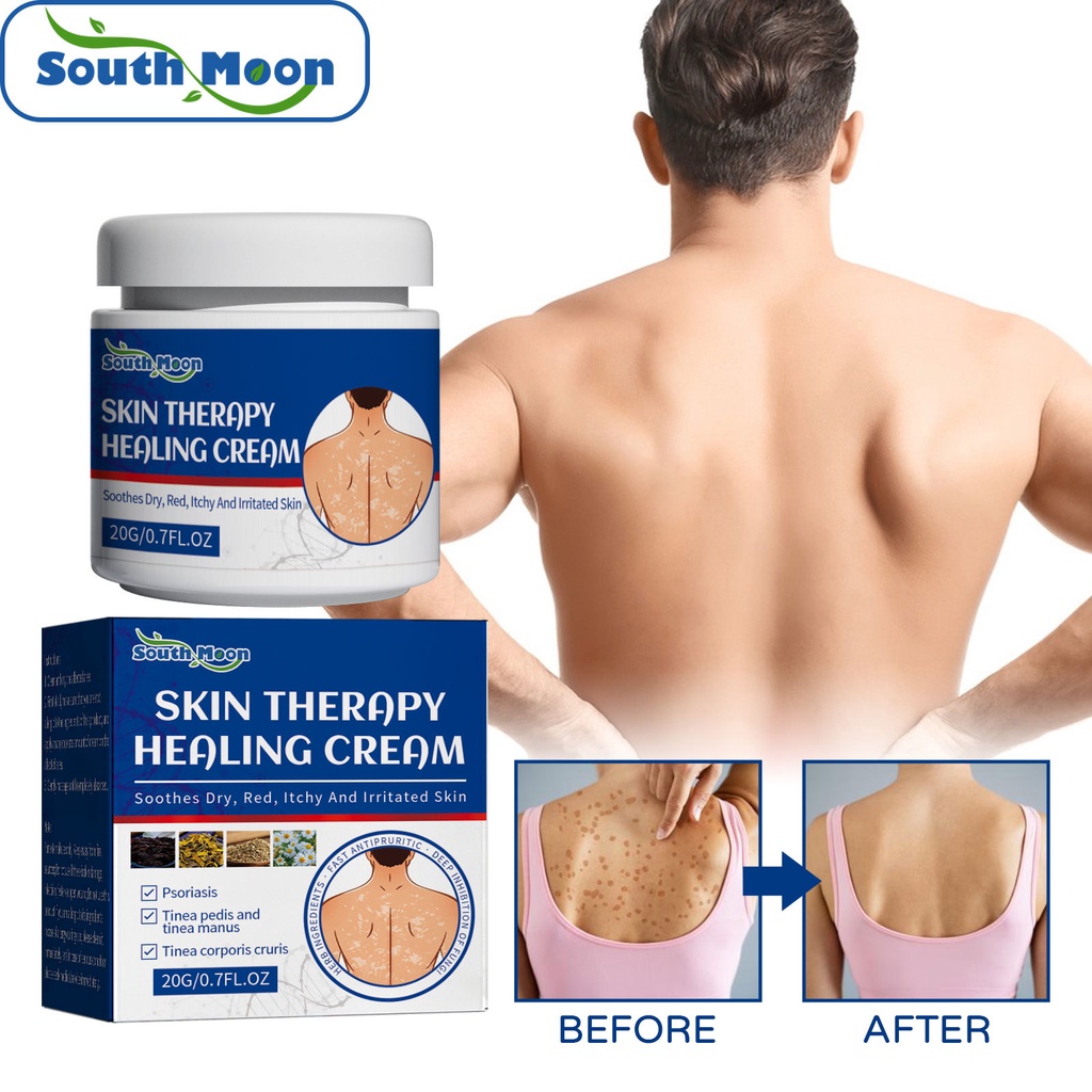 South Moon 20g Skin Therapy Healing Cream Itch Relief Dermatitis Eczema Fungal Tinea Repair 3138