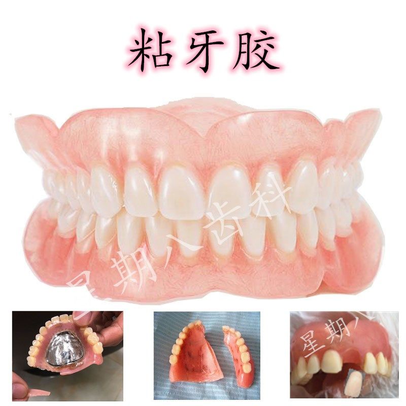 Activity dentures glue off the cementation fracture teeth denture fixed