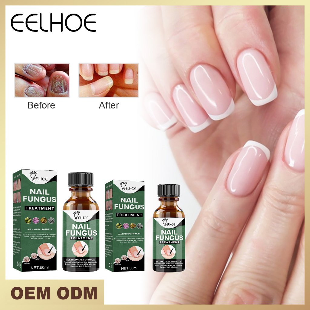 EELHOE Kuku Rosak Ubat Herbal Membaiki Kuku Rosak Kulat Nail Fungus Treatment Stop Fungal Growth