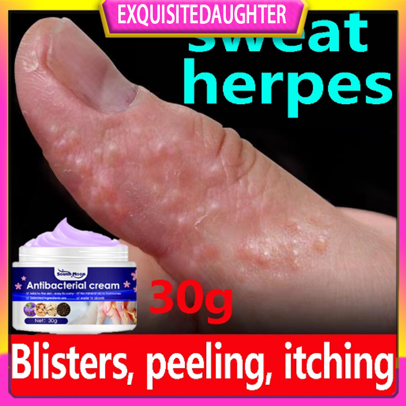 Eczema Cream Antibacterial Ointment Blisters Ointment Itching Cream