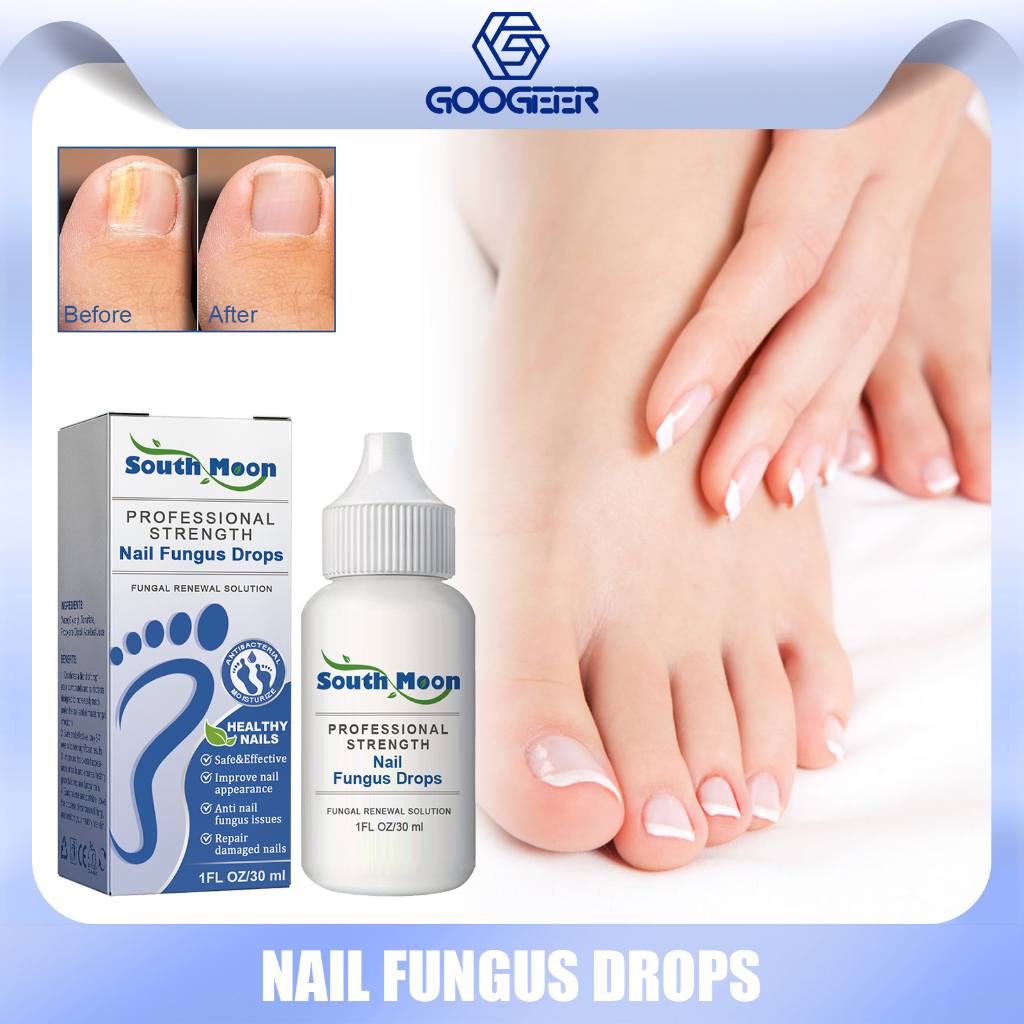 South Moon Nail Fungus Drops Anti Paronychia Relief Oil Reduce Ingrown