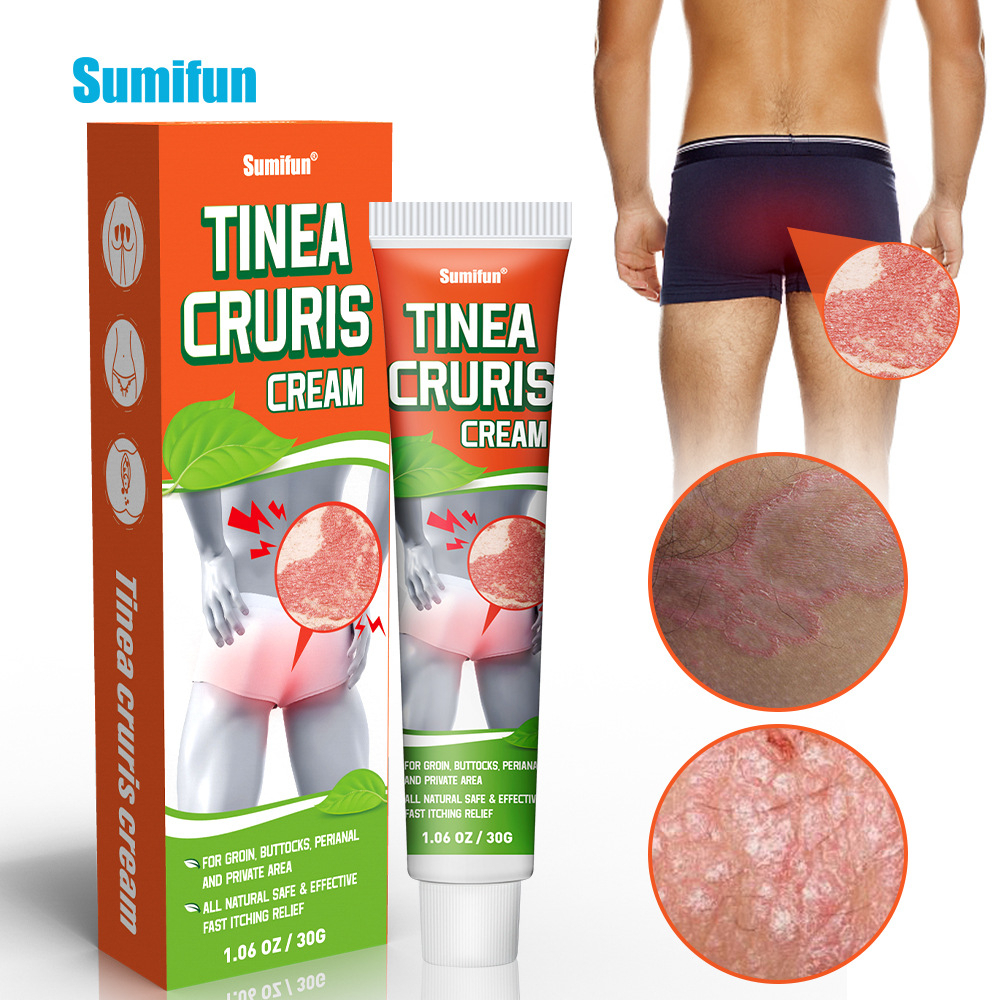 Sumifun Tinea Cruris Cream 30g Inguinal Perianal Skin Erythema Papules