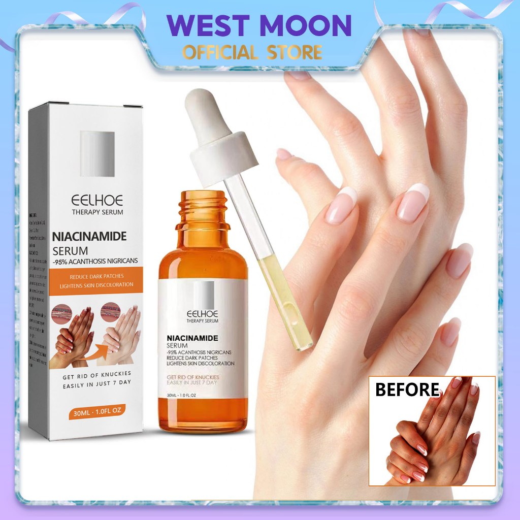 EELHOE Niacinamide Serum Effective Remove Dark Spots Anti-Aging Essence ...