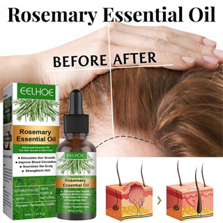 HIQILI Organic Rosemary oils for Hair Growth, Strengthening, Loss