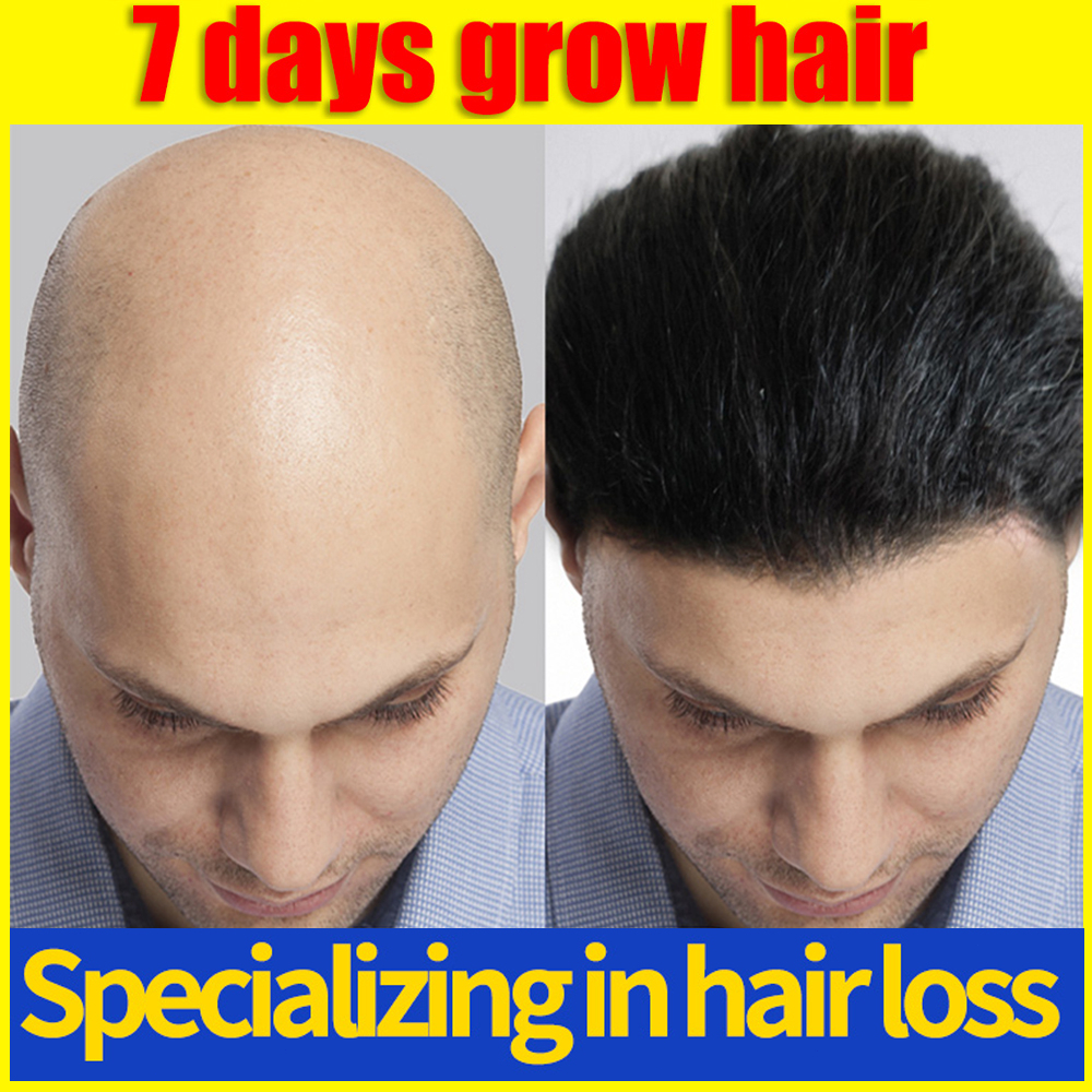 【SG Stock】Fast Hair Growth Hair Ginger shampoo Follicle Treatment Hair