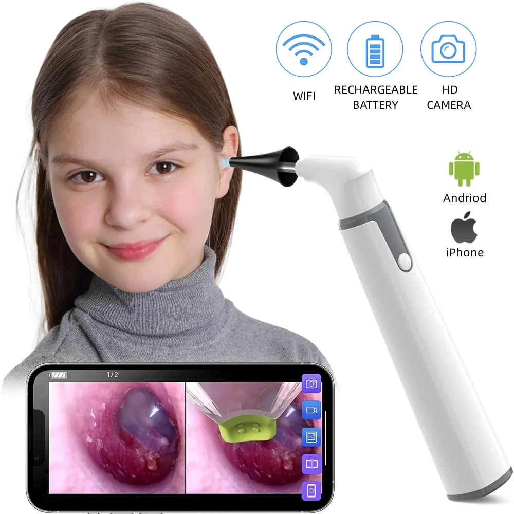 Wireless HD WIFI Visual Otoscope Ear Nose Dental Endoscope Camera ...