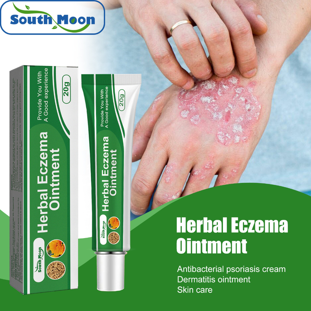 South Moon Herbal Eczema Cream 20g Psoriasis Ointment Topical Antibacterial Anti Itching