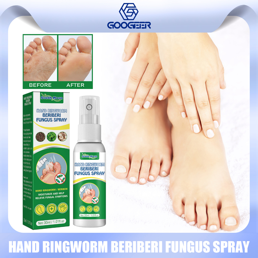 South Moon Foot Fungus Treatment Spray Anti Beriberi Infection Itch Peeling Blisters Fungal