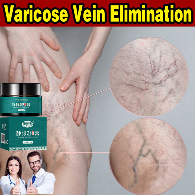 Varicose Veins Effective Remover Cream Vein Repair Cream Spider Vein Pain Killer Cream Varicose