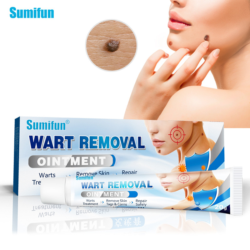 Warts Remover Original Cream Genital Herpes Condyloma Skin Tag Ez Wart Treatment Removal 2589