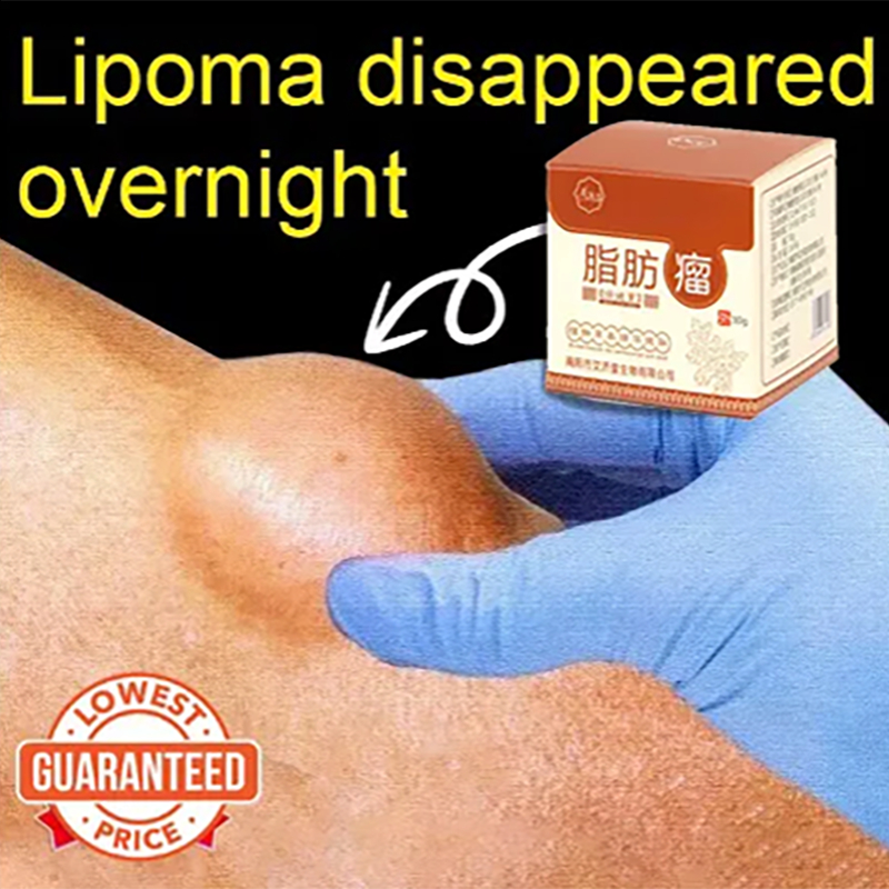 Lipoma Removal Cream 30g Removing Lumps in the Body Lymph Nodes Multiple Single Lipoma Thyroid