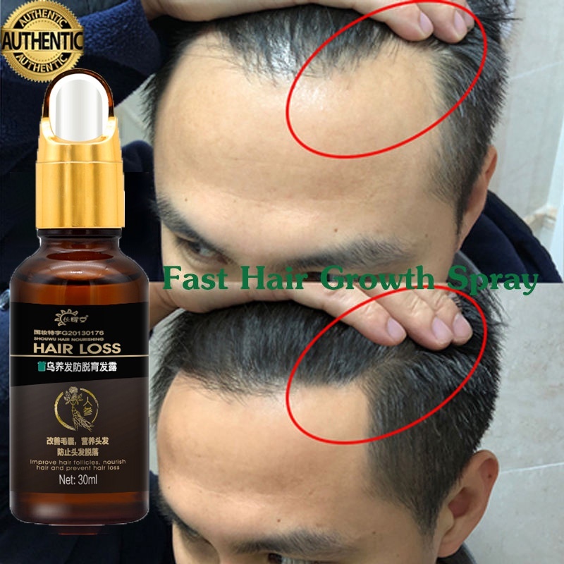 Hair serum Hair tonic for hair growth 30ml Plant extracts hair