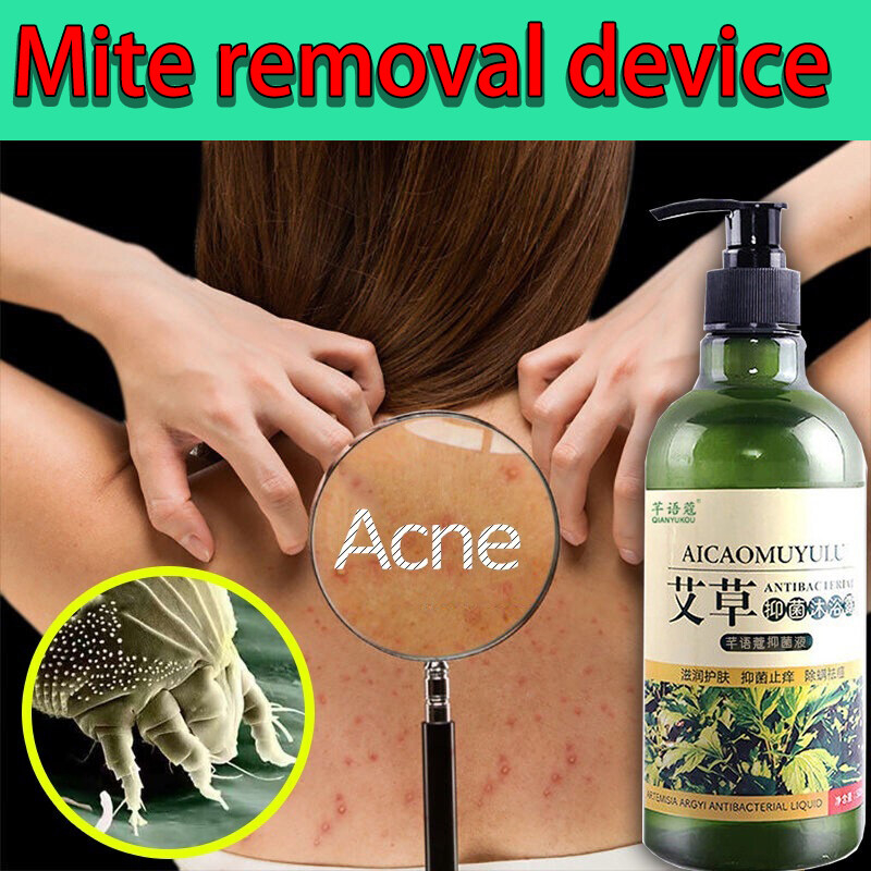 Acne Clear Body Wash 500ml Mugwort antimite and antiitch shower gel