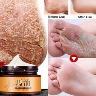 Urea Cream 42 with 2 Salicylic Acid Callus and Dead Skin Remover for Feet  Deeply Moisturizes Repairs Dry Cracked Rough Heels Elbow and Knee Effective  Urea Foot Cream with Foot File 3.5oz 3.5 oz