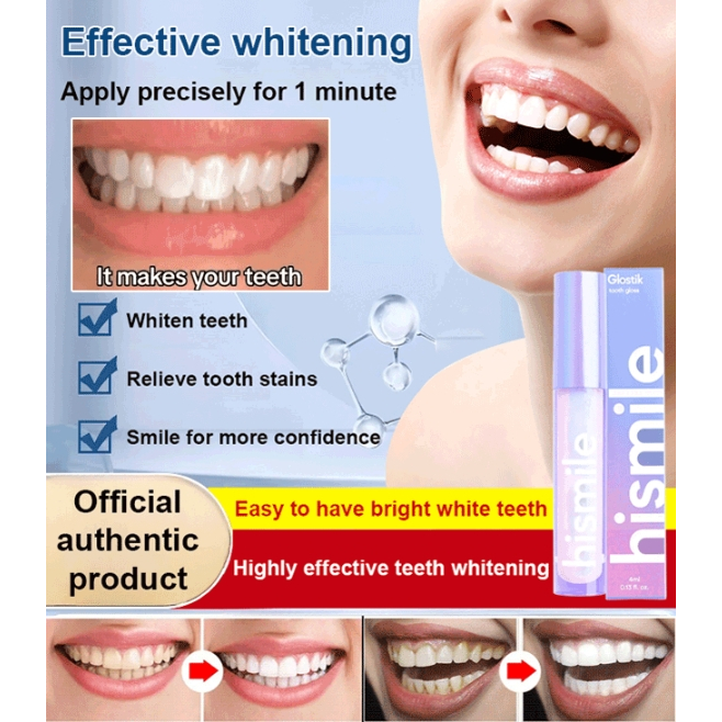 [100 Authentic] [OneSecond Whitening] V34 Teeth Brightening Whitening