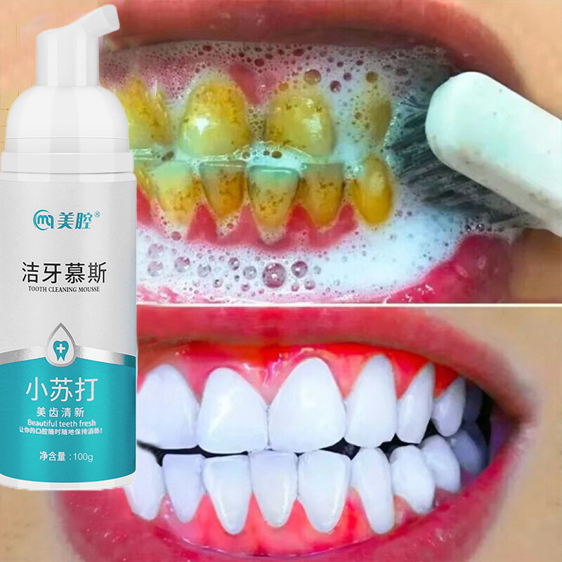 Teeth Whitening Mousse Removes Stains Yellow Teeth Teeth Whitening Oral ...