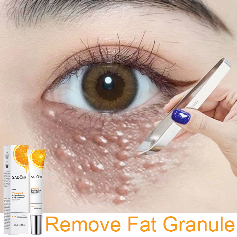 SADOER Vitamin C Eye Cream * Anti-Wrinkle Eye Cream * Remove Eye Bags ...