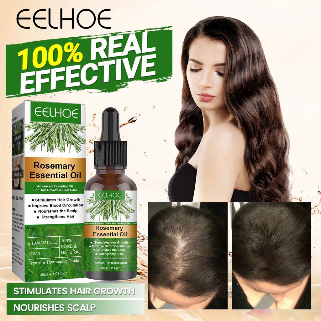 EELHOE Rosemary Essential Oil, Hair Growth Serum, 30 ml Shopee Singapore