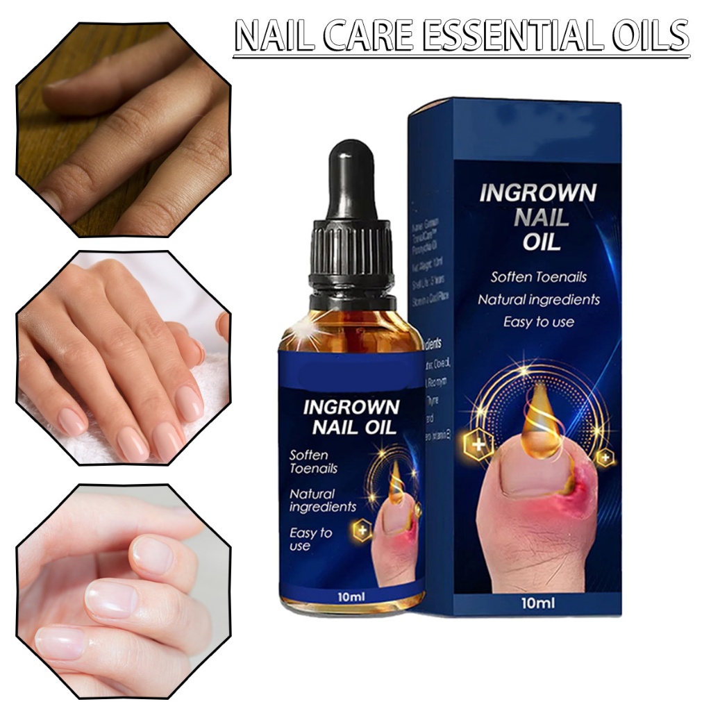 Effective Ingrown Nail Oil Toenail Renewal Liquid Anti Paronychia ...