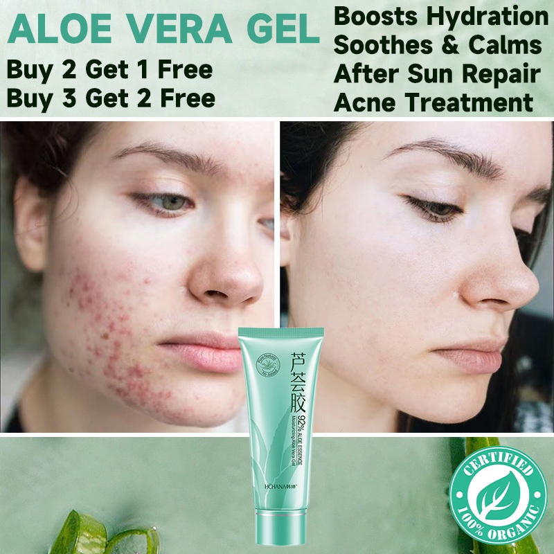 𝗔𝗹𝗼𝗲 𝗩𝗲𝗿𝗮 𝗦𝗺𝗼𝗼𝘁𝗵 𝗚𝗲𝗹 Acne Whitening Treatment Face Cream for Hydrating Moist Repair After Sun