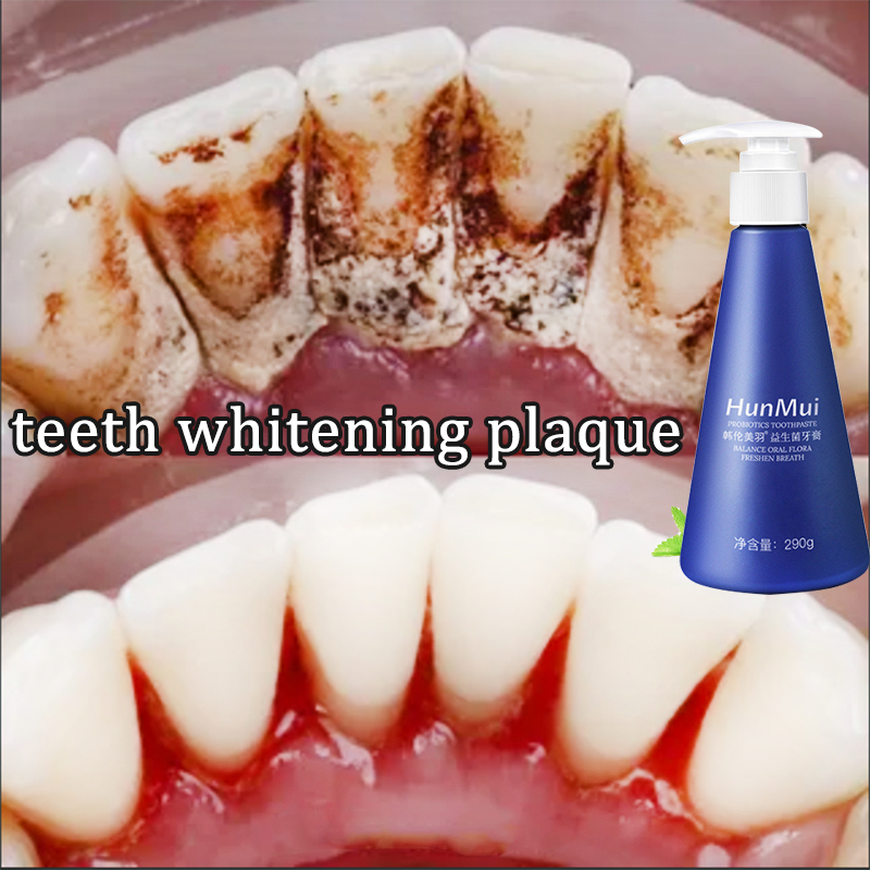 Probiotic Toothpaste teeth whitening removes plaque and tartar 290g