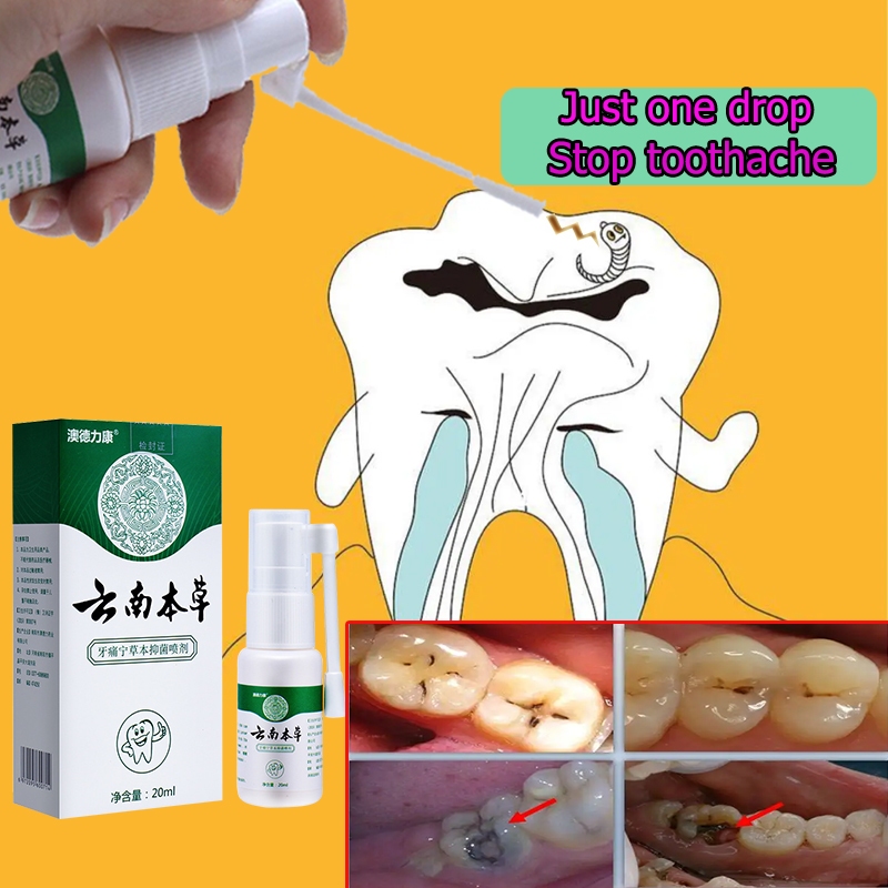 toothache medicine toothache spray 20ml Pure herbal plant extract