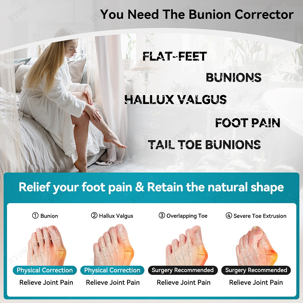 Hallux valgus bunion corrector adjustable little toe varus toe orthosis ...