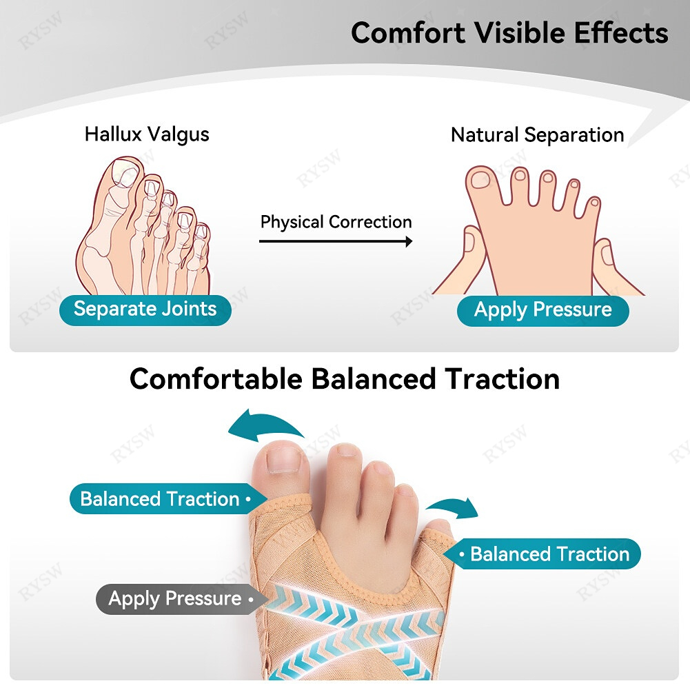 Hallux valgus bunion corrector adjustable little toe varus toe orthosis ...