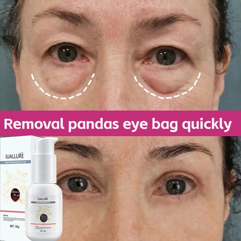 IUALLURE Herbal Eye Cream Removal Dark Circles 50g Removal Eye Bag