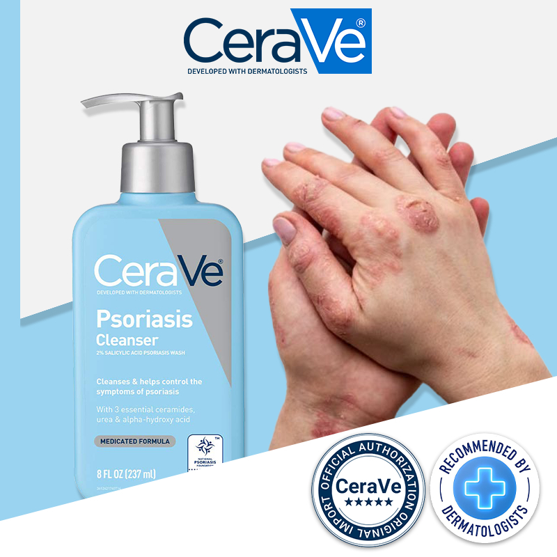 CeraVe Psoriasis Cleanser Body Wash For Eczema Psoriasis Treatment Anti Itch Antibacterial Cleanser Shopee Singapore