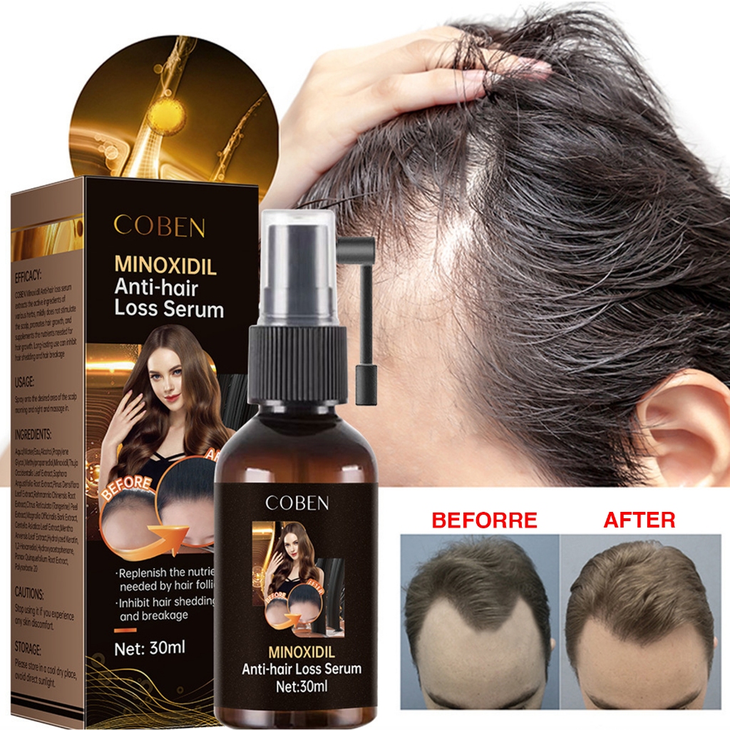 Hair Growth Tonic / for Grow Hair Anti Hair Loss / Herbal Care Essence ...