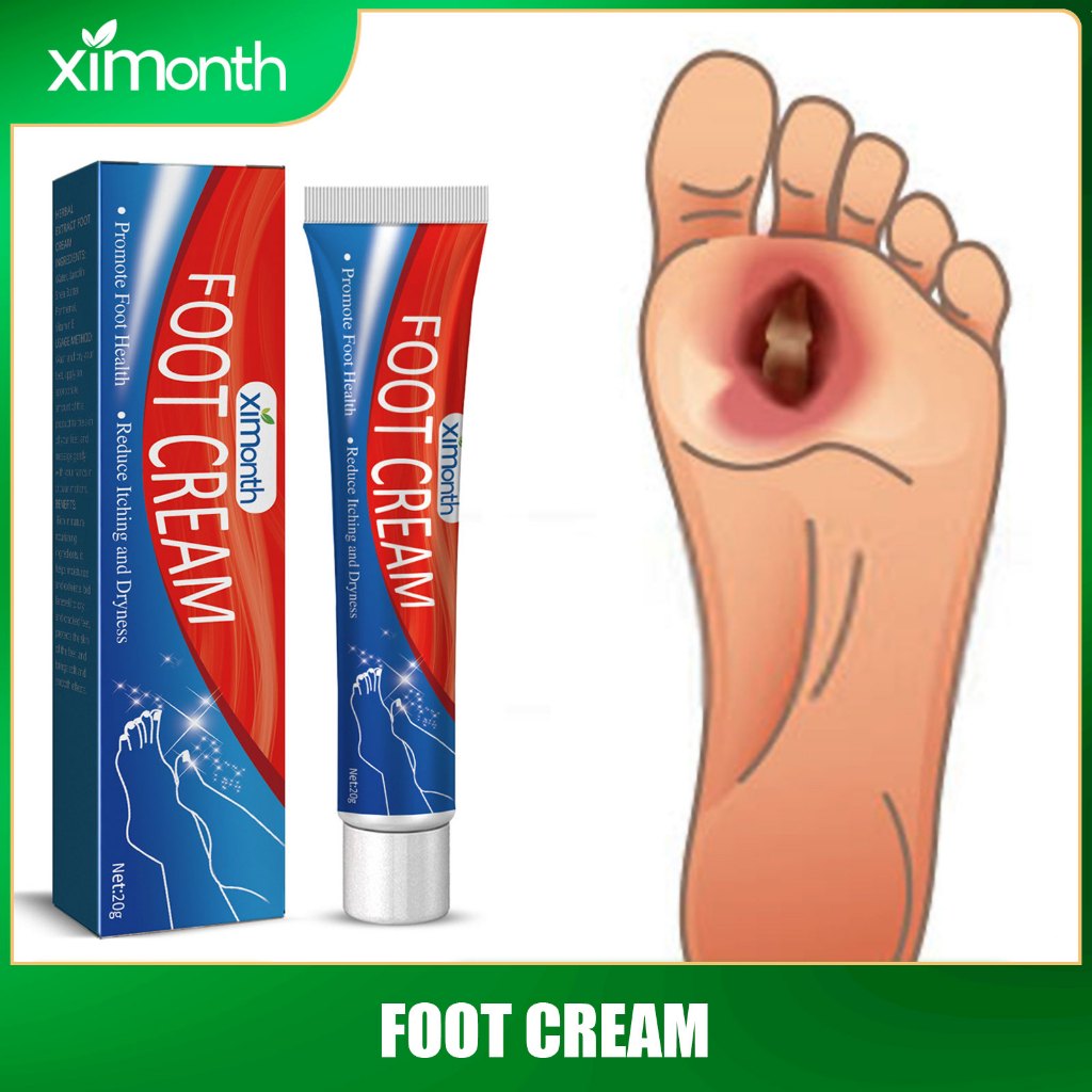Ximonth Diabetes Treatment Foot Cream Repair Feet Ulceration Relieve