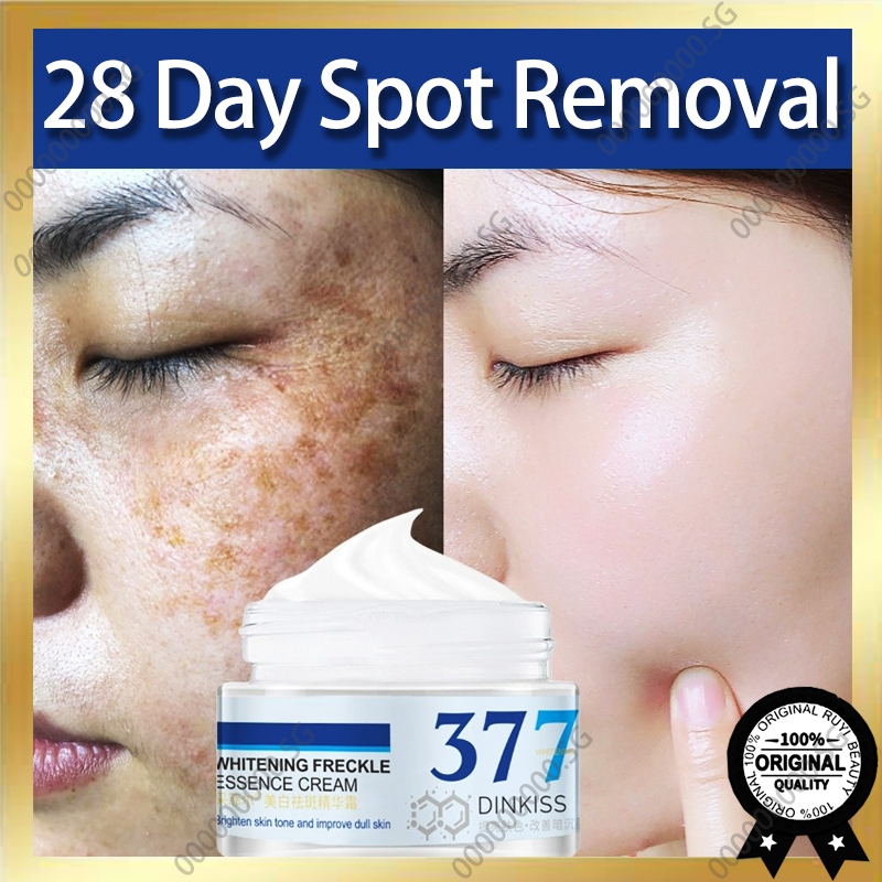 [Ready Stock ] 377 Whitening Freckle Remover Cream Dark Spot Remover