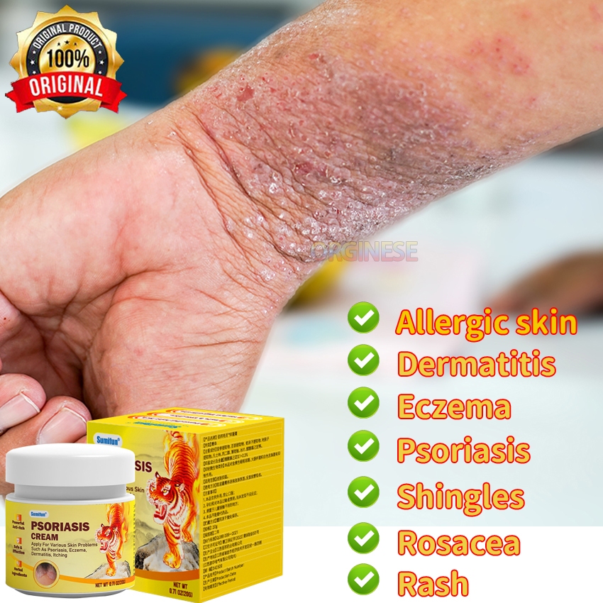 Chinese herbal ointment for pruritus eczema psoriasis antifungal cream ...