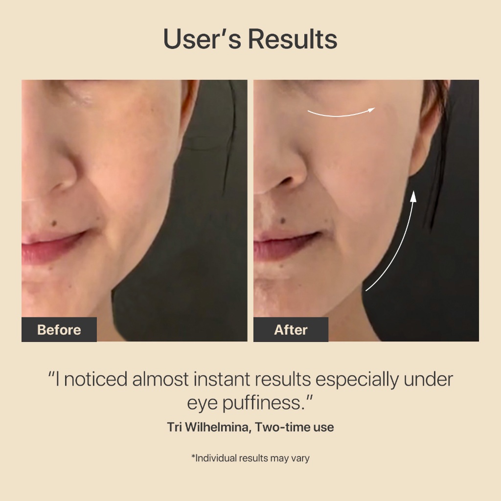 AMIRO R3 Turbo Facial RF Skin Tightening Device Microcurrent