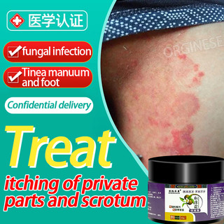 Private part itching cream itchy cream for skin jock itch antifungal ...