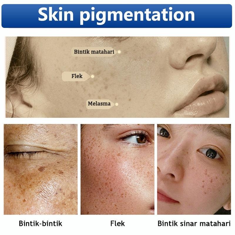 Product image 💥𝗦𝗚 𝗦𝗧𝗢𝗖𝗞💥 𝙊𝙧𝙞𝙜𝙞𝙣𝙖𝙡 377 whitening cream / 50g Freckles removal cream Dark spot remover Melanin removal cream 377 美白淡斑面霜 2