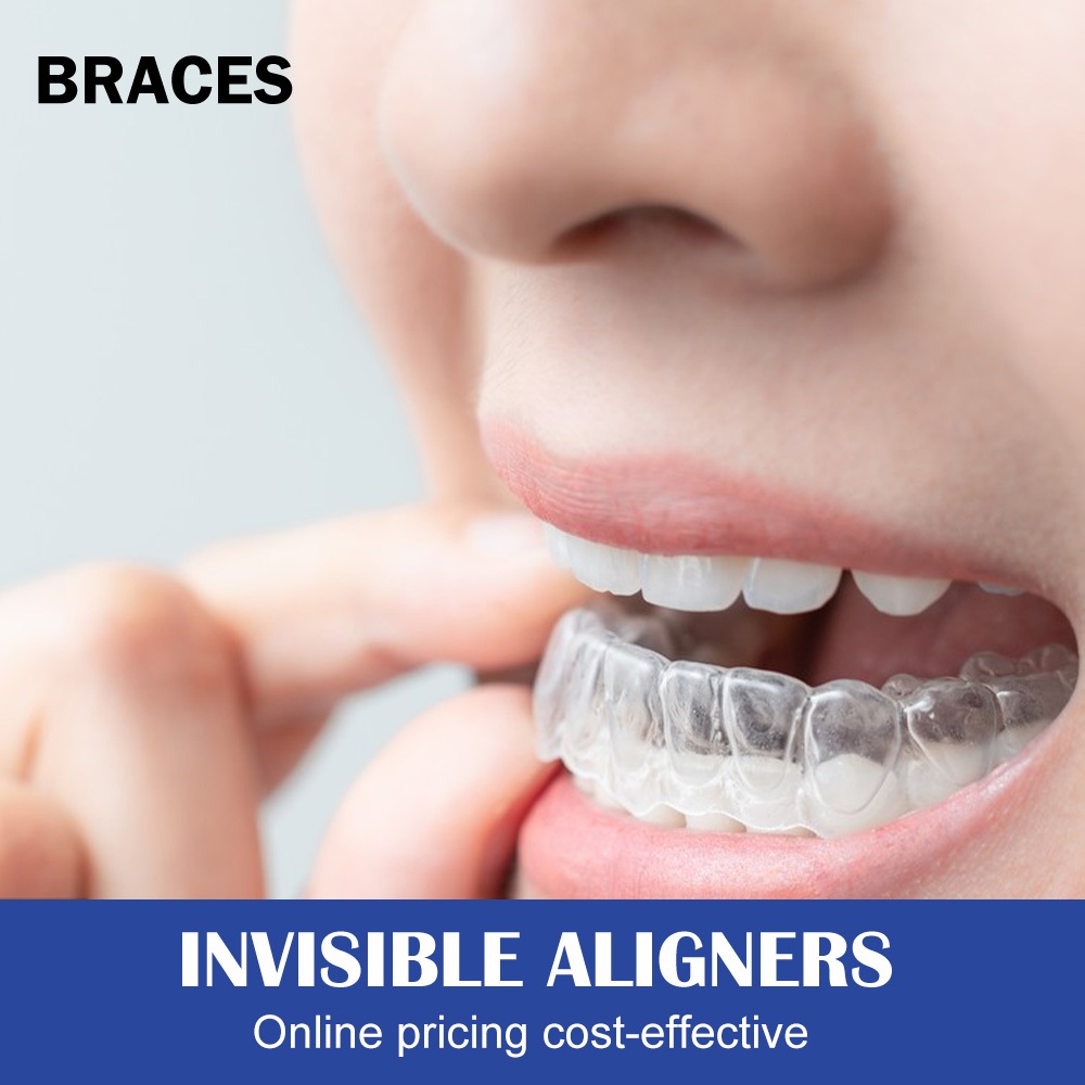 invisible aligner Night Guard Retainer for Teeth Grinding Protection ...