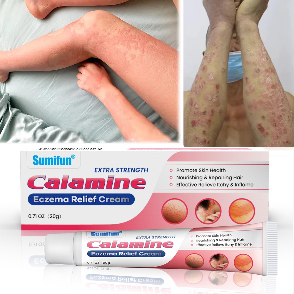 Eczema anti itch cream Calamine Lotion cream Itch Relief Herbal