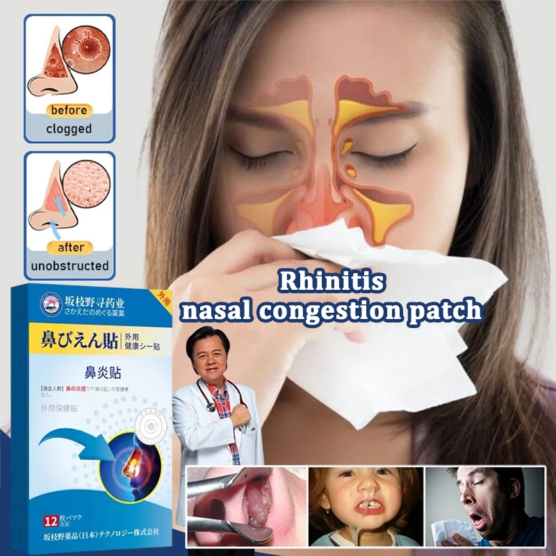 Rhinitis patch Blocked nose strip 12pcs allergic rhinitis snoring nasal ...