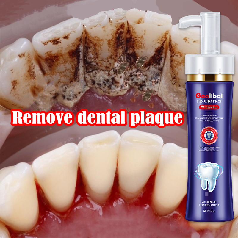 Tooth Whitening Toothpaste Tooth Decay Repair Remove Stains Yellow Oral ...