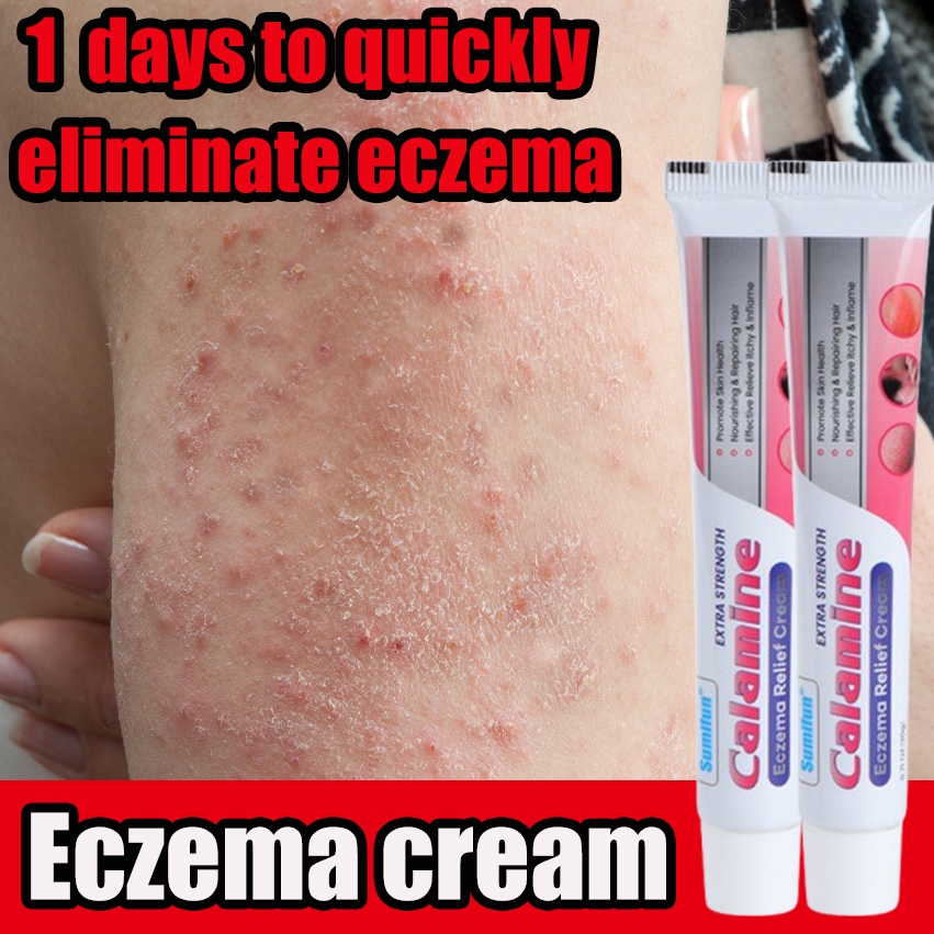 eczema cream anti itch cream antifungal cream Remove eczema 脫敏膏 redness ...