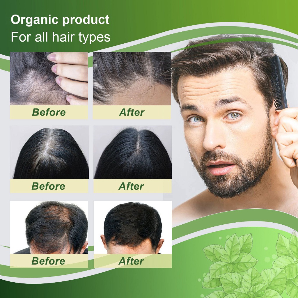 Hair Growth Tonic Spray120ml Ginger Hair Tonic for Growth Fast Hair ...