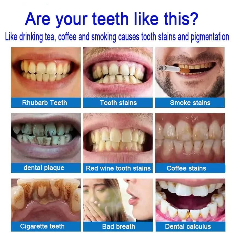 Anti-calculus toothpaste 100ml whitening toothpaste Oral & Dental ...