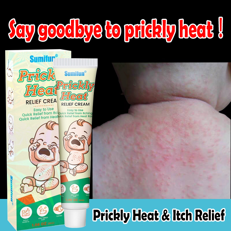 Kids & Babies Prickly Heat RELIEF CREAM 30g【Mild and non-irritating ...