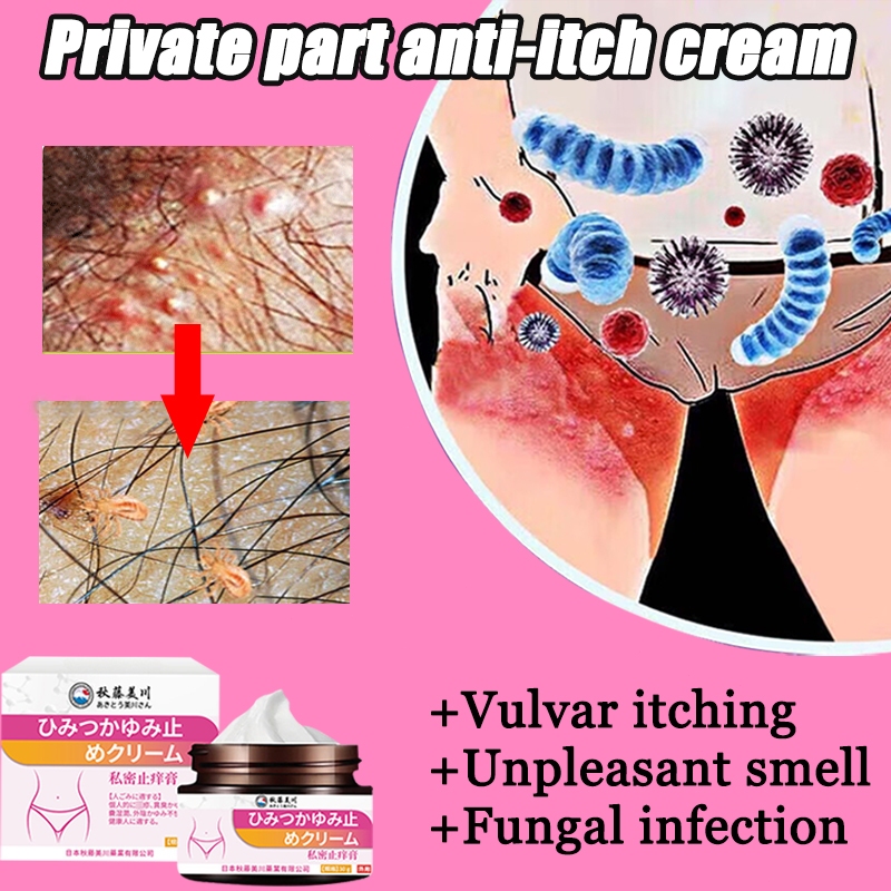 Anti itch cream eczema cream 30g private part itching cream antifungal ...