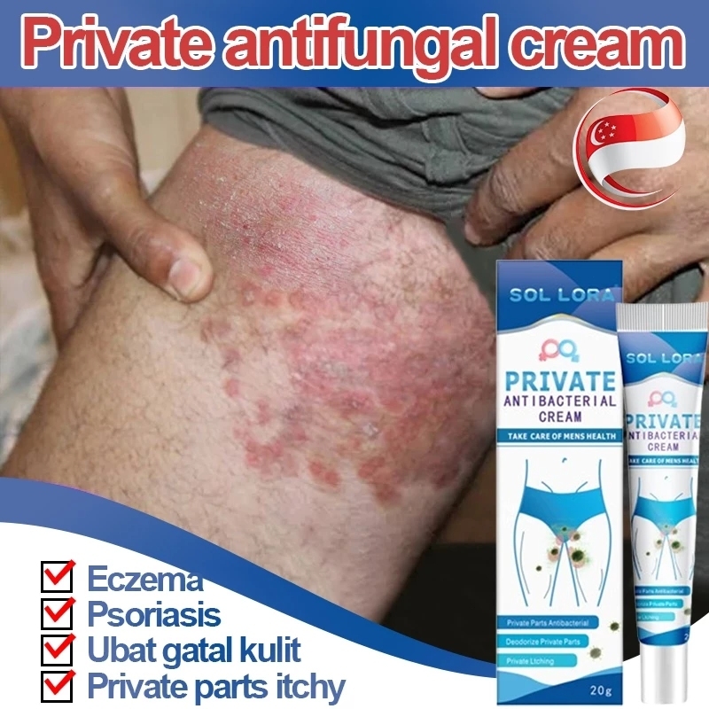 Antifungal Cream Private antibacterial cream 20g Suitable for private ...