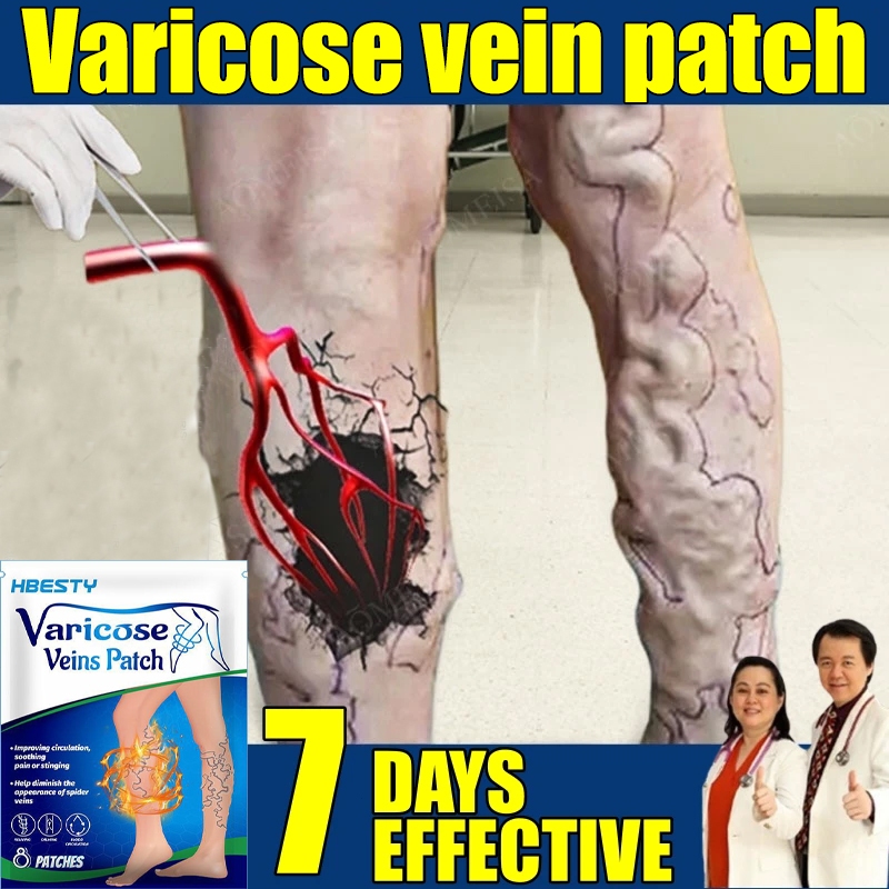 Varicose vein health care patch 8 patches/box Remove varicose veins ...