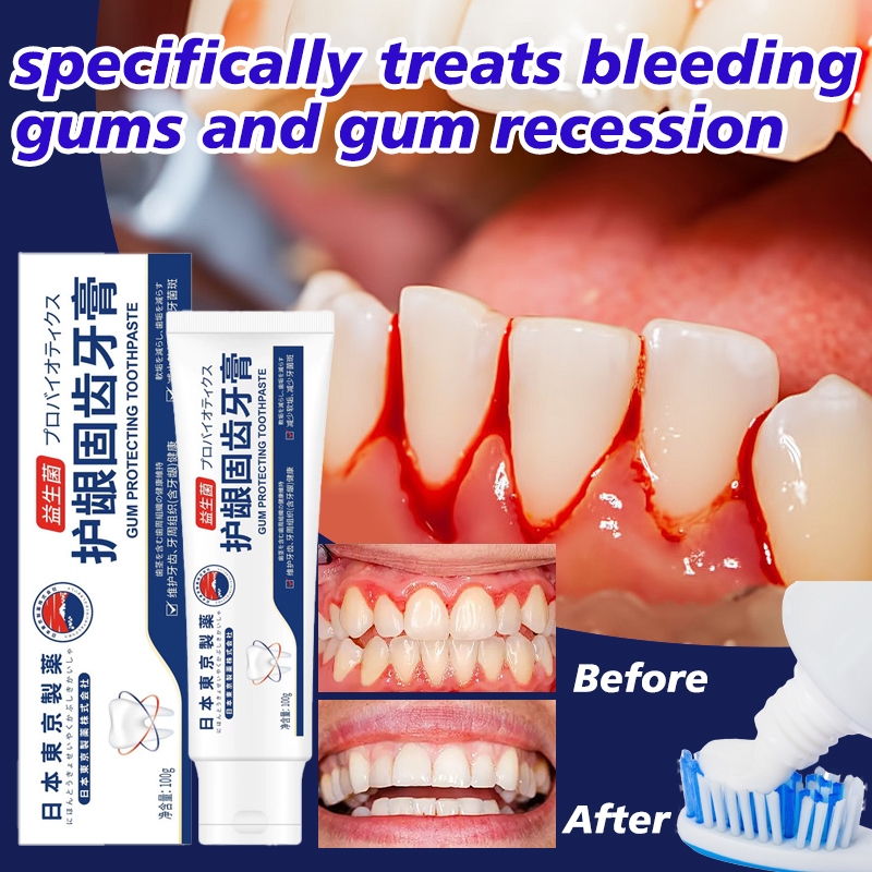 Sensitive Toothpaste 100g whitening probiotic toothpaste gum care gum ...