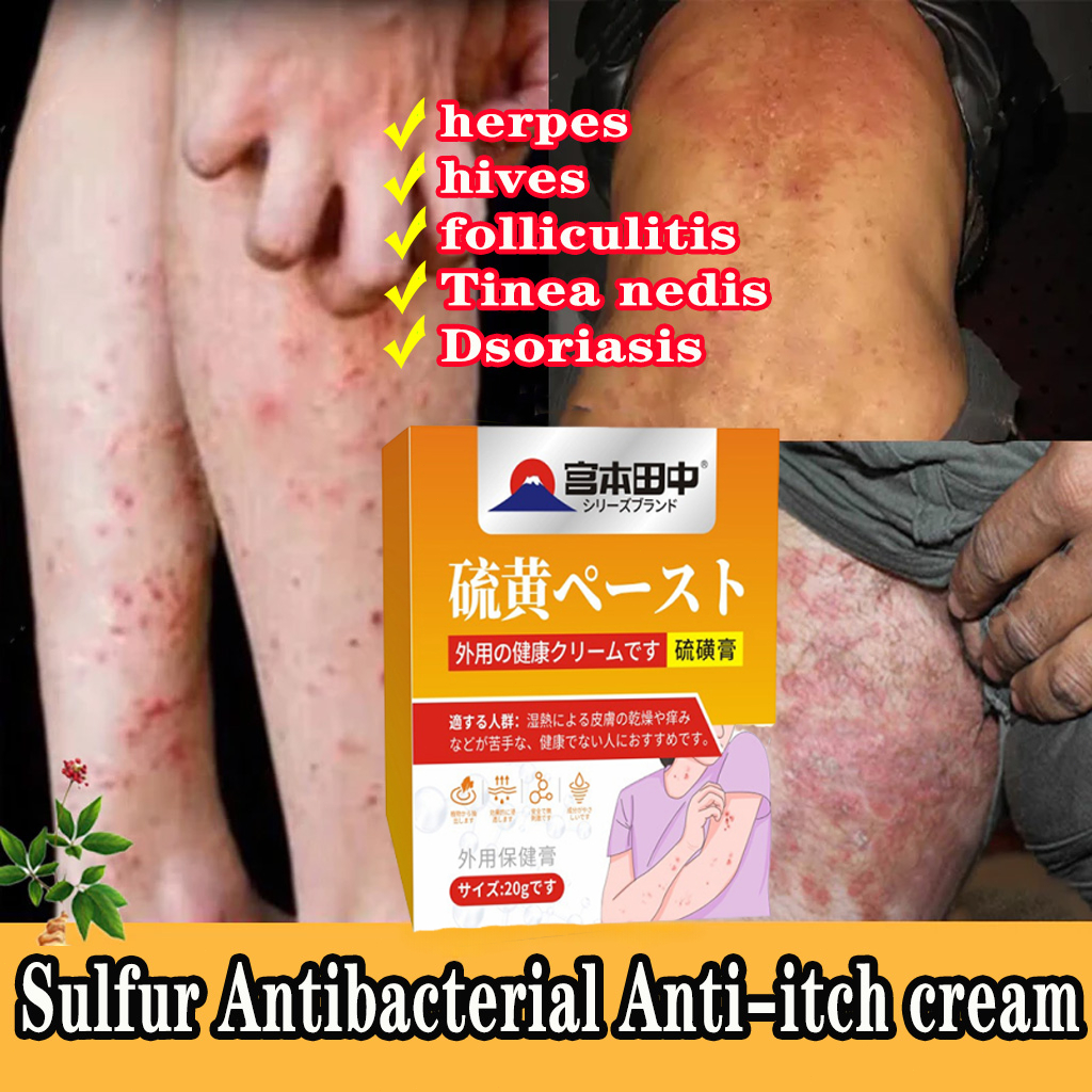Sulfur cream Herbal sulfur ointment Sulfur antibacterial ointment ...